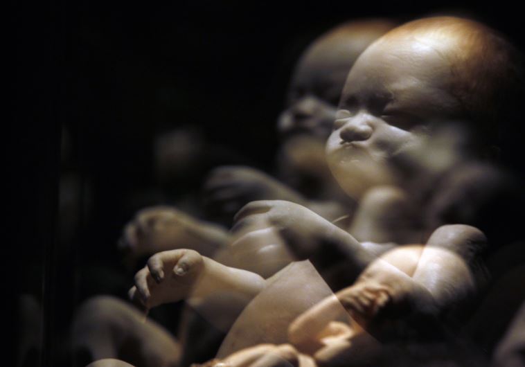 A plastinated fetus is seen during the exhibition ''Body Worlds'' by Gunther von Hagen in Rome