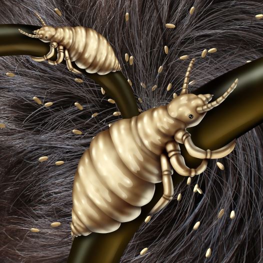 Head lice
