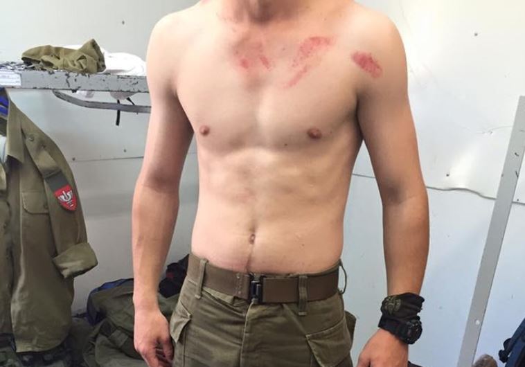 Christian Aramean soldier from near Nazareth who was attacked Sunday morning by Arab Muslims on way to his base