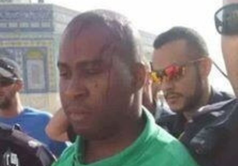 Tourist attacked at Temple Mount