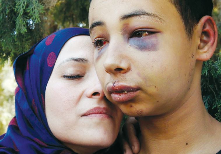 American teen Tariq Khdeir is greeted by his mother after being released from jail in Jerusalem on July 6, 2014